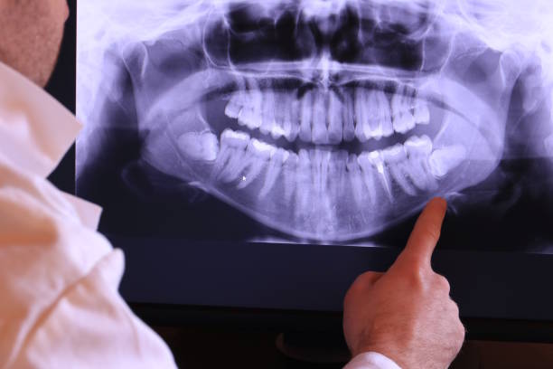 Best Tooth Pain Emergency Relief  in Ashley, OH